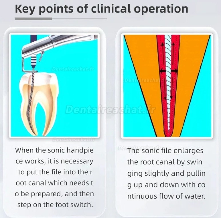 Pièce à main sonic endo activator, pneumatique endoactivator dentaire avec 2 aiguilles à limer